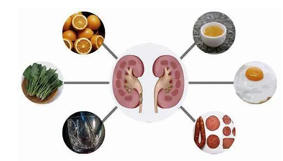 肾结石是如何形成的，得了肾结石我们要怎么做