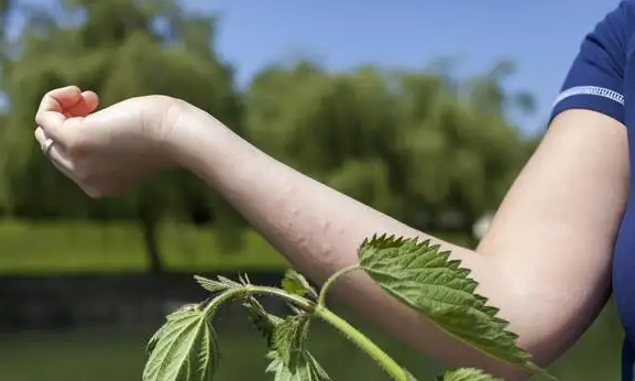 秋季体质差的人更易得荨麻疹吗?荨麻疹会随着自身恢复自愈吗?