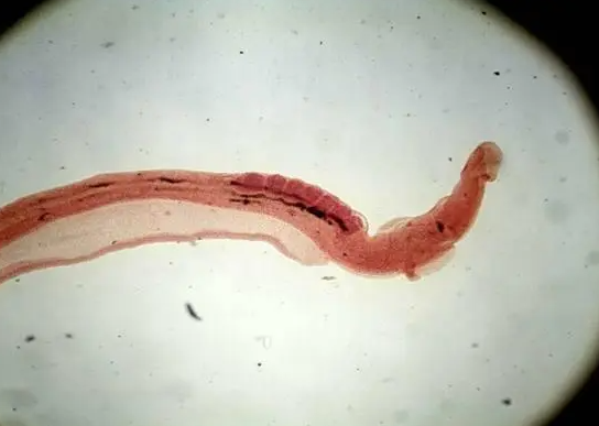 肺吸虫病是什么病 怎样预防寄生虫的感染