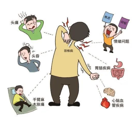 退行性病变是颈椎病的原因吗?退行性病变严重时期的症状