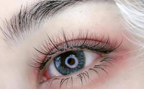 医生回应女子眼角掉出74根眼睫毛 眼科专家揭秘眼健康真相!