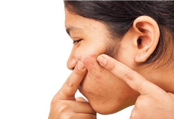 男子挤破身上痘痘住进ICU 重度细菌感染引发筋膜炎 男子挤破身上痘痘住进ICU 重度细菌感染引发筋膜炎