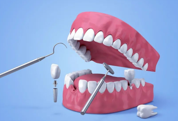 3.2万种植牙咬个黄瓜片牙冠碎了 种牙后就能随意咬硬物?