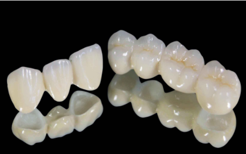 3.2万种植牙咬个黄瓜片牙冠碎了 种牙后就能随意咬硬物? 3.2万种植牙咬个黄瓜片牙冠碎了 种牙后就能随意咬硬物?