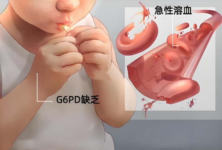 惊！蚕豆病竟有 “重男轻女” 特性，家长务必知晓