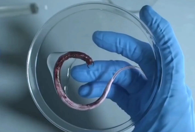 5岁女童泡温泉后被确诊感染食脑虫 食脑虫到底离有多可怕?