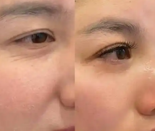 护肤保养方法层出不穷，常见护肤误区你中招了么？