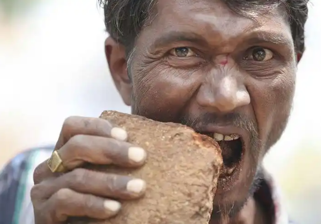 16岁秃头少女胃内查出巨大肿块,开腹后竟取出4斤头发团 16岁秃头少女胃内查出巨大肿块,开腹后竟取出4斤头发团