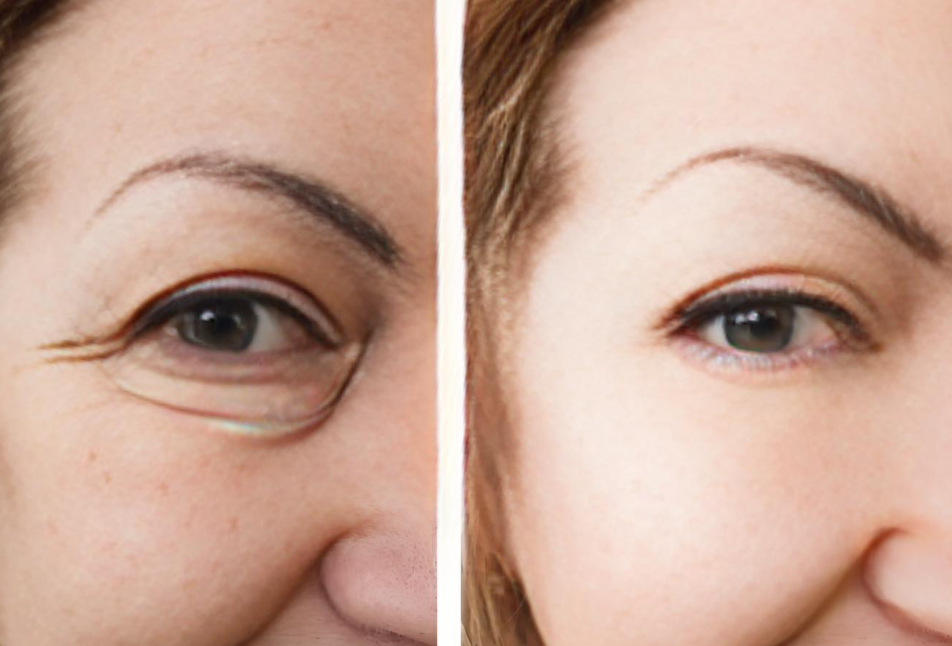 立秋后怎样防止眼袋形成?秋季最有效的去除眼袋的小技巧有哪些? 立秋后怎样防止眼袋形成?秋季最有效的去除眼袋的小技巧有哪些?