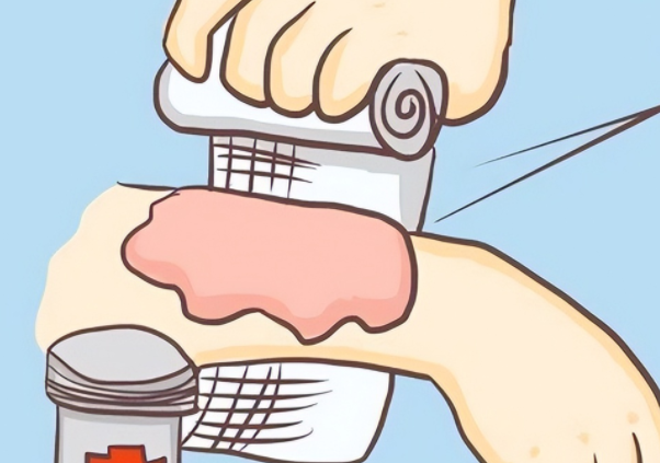 女子伤口似发霉听网友劝连夜就医 女子脚被扎后长出癌中之王!