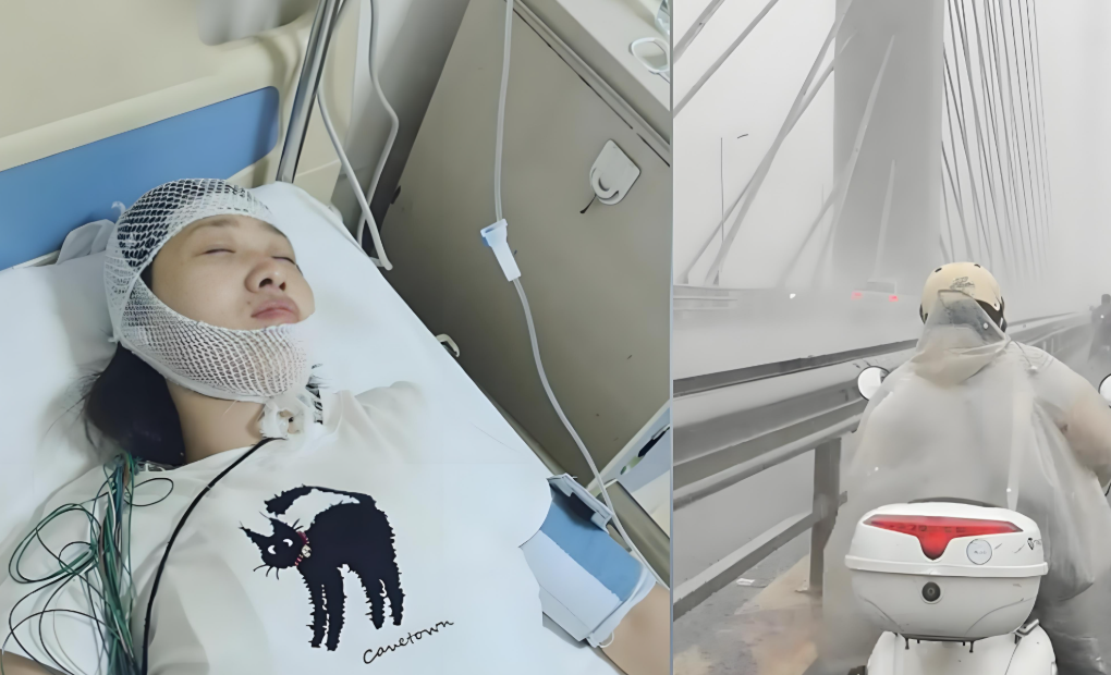 淋雨后不当回事？当心脑膜炎找上门！一女士淋雨十几分钟确诊脑膜炎！