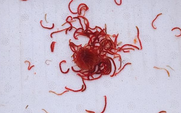 酒店浴缸出现红线虫 如何预防红线虫出没