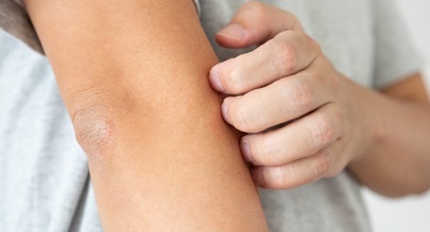 秋季换季皮肤干痒?试试燕麦浴+3倍饮水法缓解皮肤干痒! 秋季换季皮肤干痒?试试燕麦浴+3倍饮水法缓解皮肤干痒!