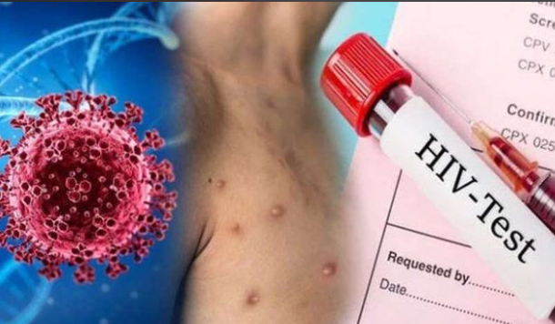 韩国将尼帕病毒感染列为一级传染病 青少年感染尼帕病毒最危险