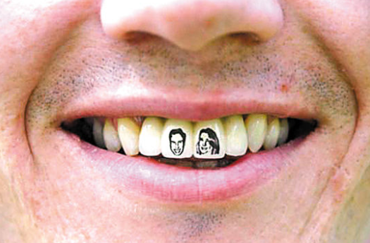 牙齿文身风靡齿科，“发财”牙冠一夜爆火是潮流还是胡闹?