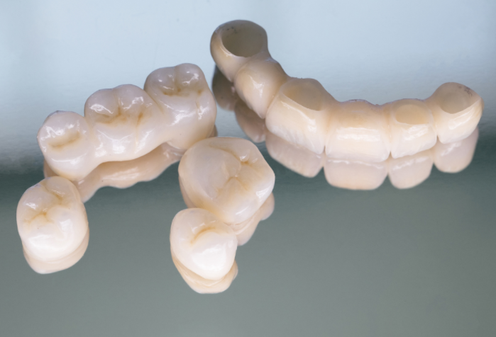 牙齿文身风靡齿科，“发财”牙冠一夜爆火是潮流还是胡闹?