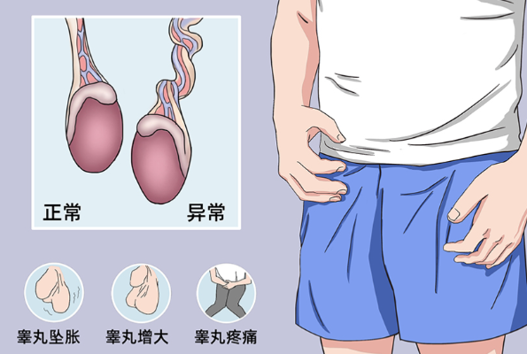 睾酮低有什么症状 造成睾酮低的原因有哪些
