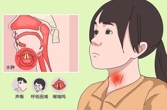 喉咙左侧吞咽疼痛可能是什么原因导致的 哪些疾病会造成喉咙吞咽疼痛