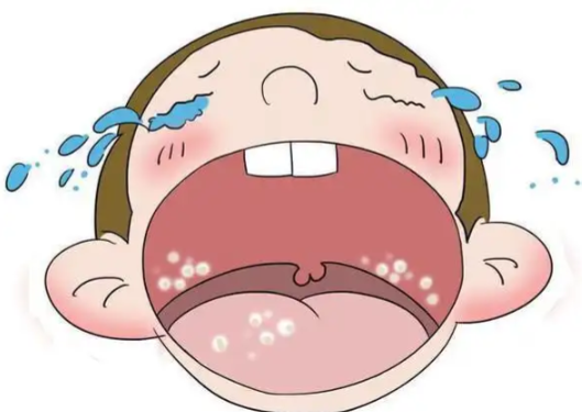 口蹄疫的治疗方法有哪些 未成年小孩如何预防口蹄疫