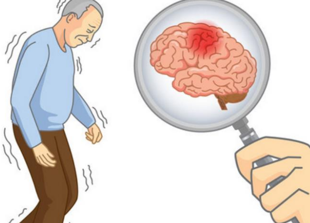 交警多问一句察觉司机有中风前兆，中风的男性一般有啥前兆？