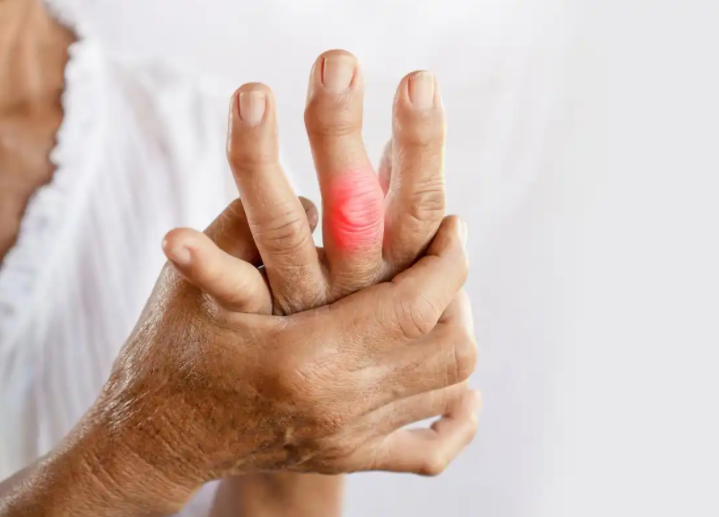 4年级小学生尿酸飙到440?痛风年轻化的真凶是谁?