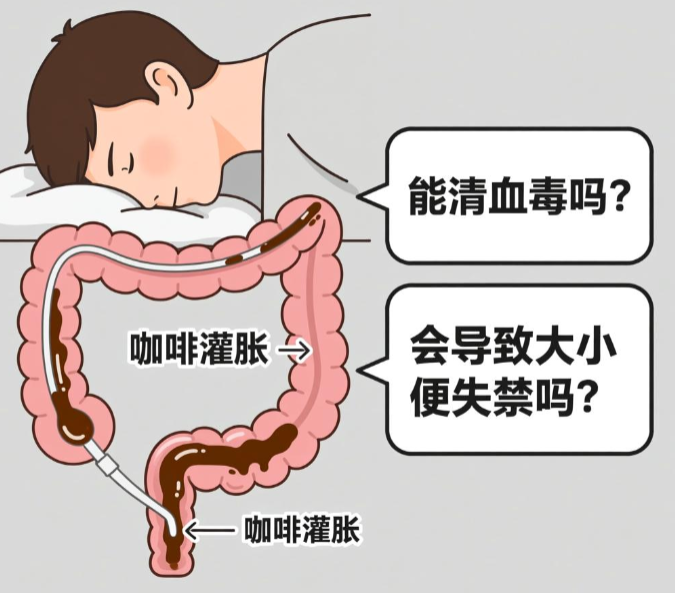 咖啡灌肠能清血毒吗(咖啡灌肠会导致大小便失禁吗)