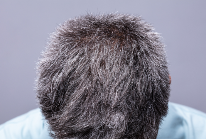 白头发是身体发出的压力警告(压力下的头发变白能预防癌症吗) 白头发是身体发出的压力警告(压力下的头发变白能预防癌症吗)