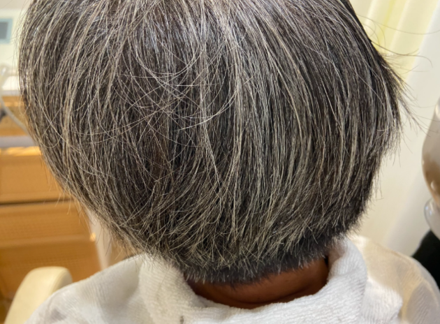 白头发是身体发出的压力警告(压力下的头发变白能预防癌症吗) 白头发是身体发出的压力警告(压力下的头发变白能预防癌症吗)