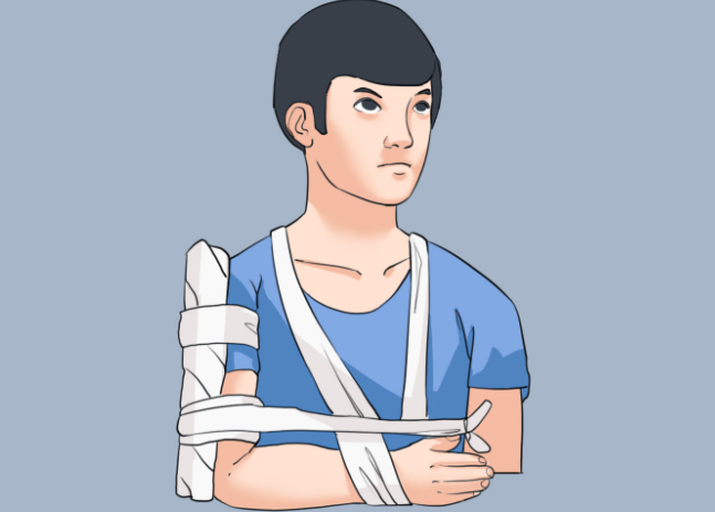 25岁女子取髓内钉患骨髓炎，髓内钉到底取不取?