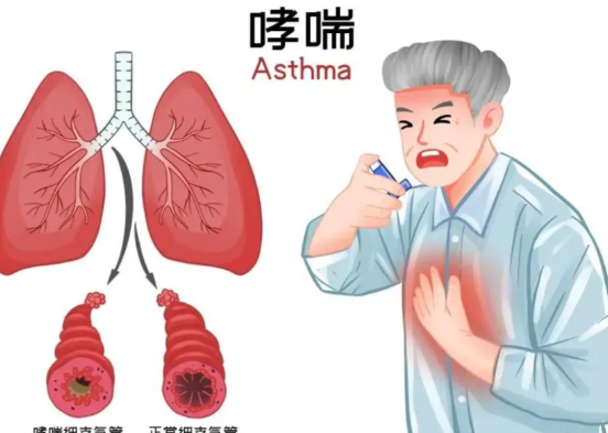 哮喘病患者不能食用哪些水果 哮喘病患者不能接触哪些食物