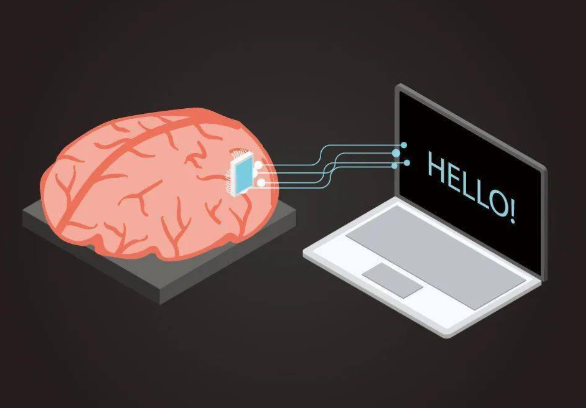 首例“医保价”脑机接口手术完成 脑机接口技术正式进入医疗服务收费目录体系