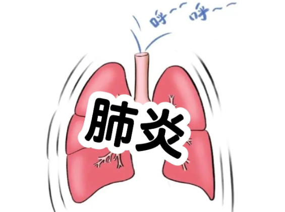 吸入性肺炎症状有哪些前期症状 吸入性肺炎患者治疗后生活要注意什么