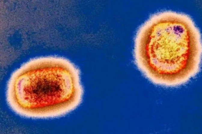 佛山鸟屎袭城无需恐慌，佛山近两个月天降大量“鸟屎雨”