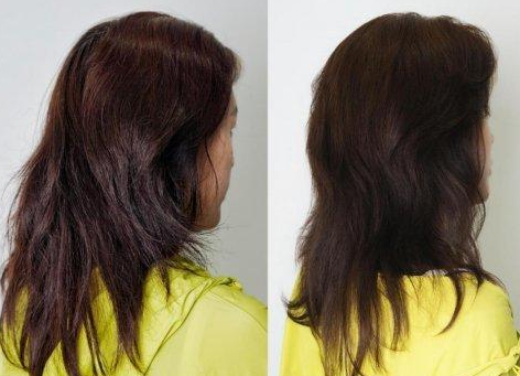 冬季头皮屑增多怎么办？2025控油去屑护理实用小技巧大全