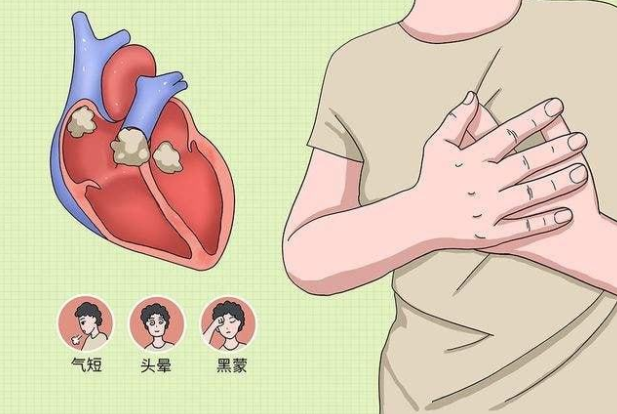 我国流感活动下降还需注意心肌炎，如何避免感冒诱发心肌炎？