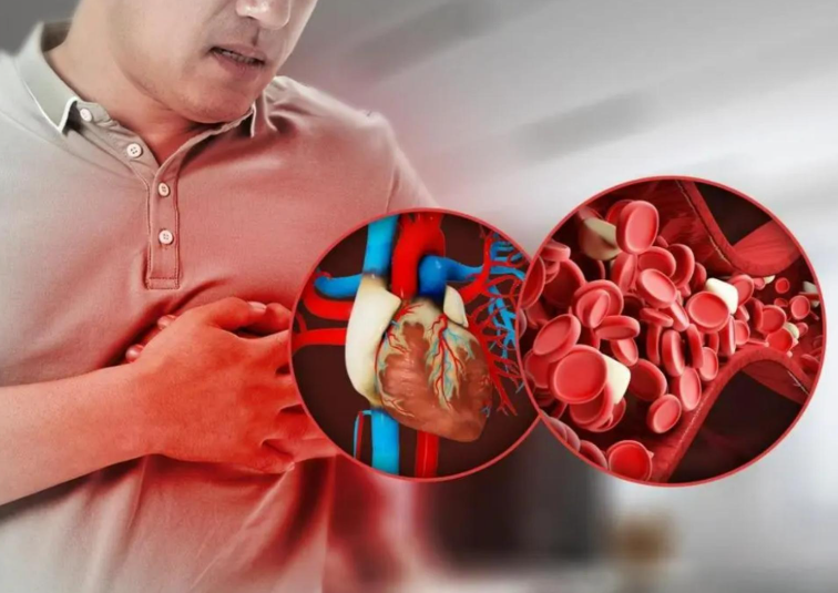 过年打游戏到凌晨3点突发心梗,2026春节这些坏习惯可能会导致心梗 过年打游戏到凌晨3点突发心梗,2026春节这些坏习惯可能会导致心梗