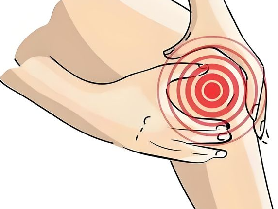 膝盖凹陷处疼可能是什么原因造成的 膝盖凹陷处疼如何缓解 膝盖凹陷处疼可能是什么原因造成的 膝盖凹陷处疼如何缓解