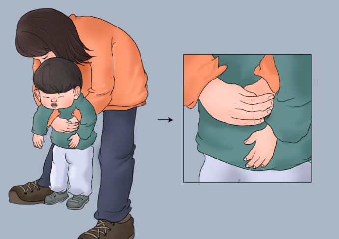 2026海姆立克急救法更新了!海姆立克急救法新升级了哪些？