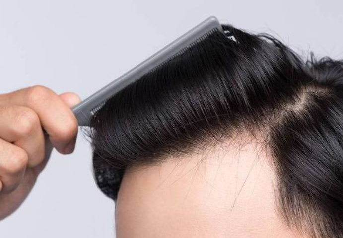 气血足的人头发有3个特征，头发是身体健康的报警器?