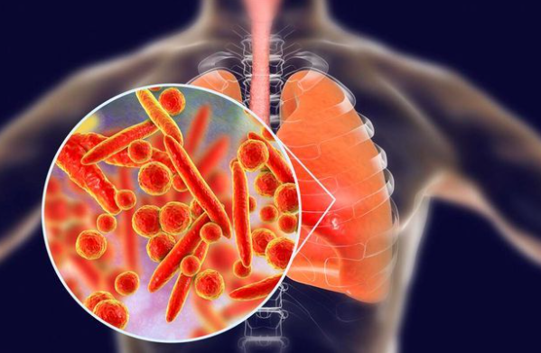 冬季发烧是感冒还是合胞病毒?2026发烧患者如何辨别自身病情? 冬季发烧是感冒还是合胞病毒?2026发烧患者如何辨别自身病情?
