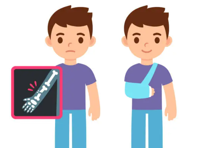 爸爸辅导孩子作业气到拍桌致手骨折?给当代父母的作业拯救指南