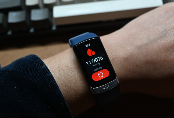 有一种焦虑叫“手表说我没睡好” 智能穿戴设备不能替代医学检查检验