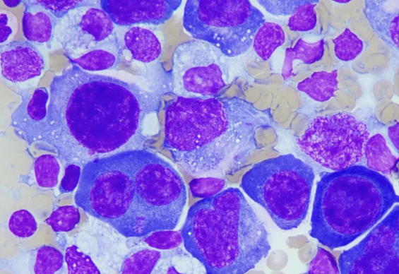 部分脊椎动物肢体可再生机制被揭示 神经嵴细胞可能在再生能力中发挥关键作用