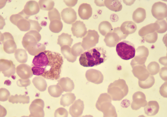 部分脊椎动物肢体可再生机制被揭示 神经嵴细胞可能在再生能力中发挥关键作用