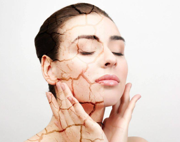 冬季痰湿体质容易导致皮肤干燥开裂吗?如何科学调理能养出水润肌?