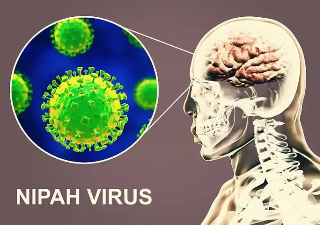 中国已将尼帕病毒列入监测，2026过年回家如何预防尼帕病毒感染？