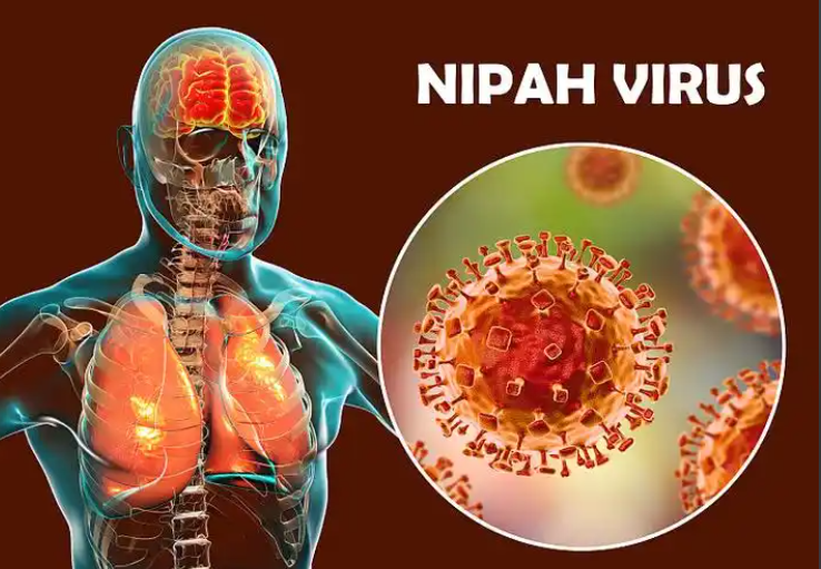 印度暴发尼帕病毒疫情,尼帕病毒感染死亡率可达40%以上 印度暴发尼帕病毒疫情,尼帕病毒感染死亡率可达40%以上