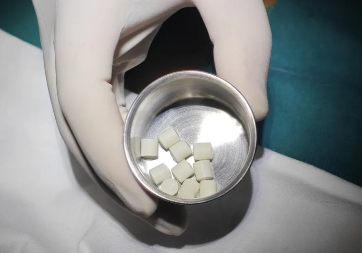 植入戒酒芯片可以戒掉20年酒瘾吗?腹部植入芯片就能戒酒瘾?