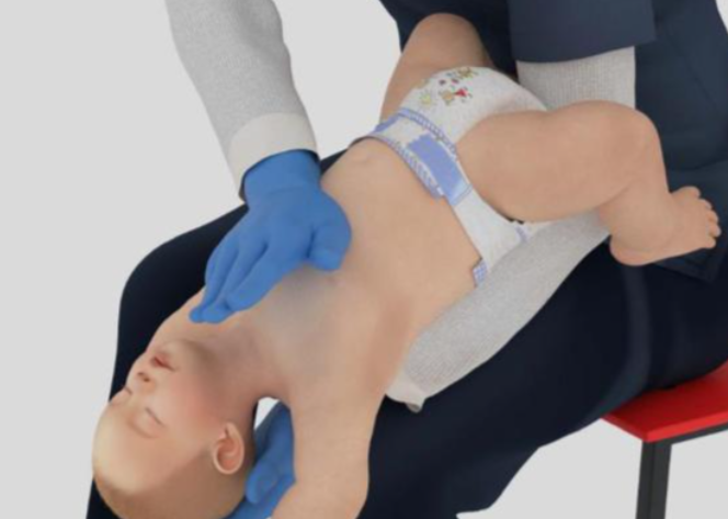 “海姆立克急救法”更新了！2026新版海姆立克急救法全民科普指南