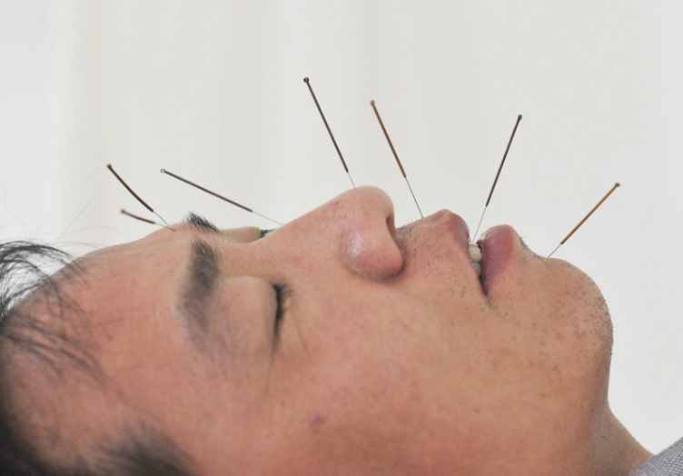 返乡温差面瘫防护很重要!2026年春运面瘫风险防范特别建议 返乡温差面瘫防护很重要!2026年春运面瘫风险防范特别建议